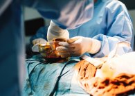 Обрезание рук врача, держащего силиконовый грудной имплантат, и обнаженная пациентка, лежащая с ланцетом во время операции — стоковое фото