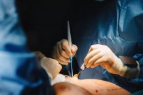 Посев неузнаваемый человек руки делает операцию с инструментами и медсестра урожая — стоковое фото