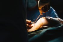 Cirujano plástico cosiendo mama de paciente femenina después de insertar implantes en quirófano - foto de stock