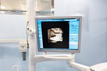 Monitor su sedia dentale con foto dei denti — Foto stock