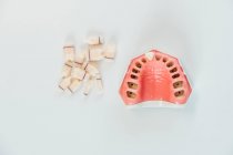 Gros plan d'une prothèse dentaire dans un laboratoire — Photo de stock