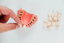 Крупним планом зубний протез в лабораторії — стокове фото