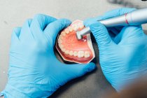 De arriba recortado aprendiz dentista anónimo en guantes azules realizar la operación dental con bur tallado molde dental mientras se trabaja en el laboratorio - foto de stock