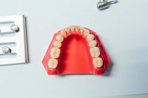 Крупним планом зубний протез в лабораторії — стокове фото