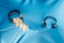 De dessus de barrage en caoutchouc bleu installé sur mannequin en plastique pendant la formation en traitement dentaire sur le cours de dentisterie — Photo de stock