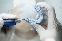 From above of crop anonymous dentist in medical gloves grinding dental prosthesis with professional tool while working in modern laboratory — Stock Photo