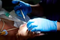 Schnupfen anonymer Chirurg in medizinischer Uniform und Handschuhen macht Injektion mit Spritze während der Durchführung von Rhinoplastik Operation für weibliche Patientin — Stockfoto