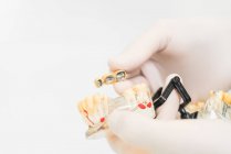 Анонімний стоматолог в захисних латексних рукавичках, що показують протези зубів з імплантатами, підвішені в сучасній клініці — стокове фото