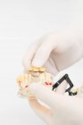 Анонімний стоматолог в захисних латексних рукавичках, що показують протези зубів з імплантатами, підвішені в сучасній клініці — стокове фото