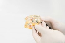 Crop dentiste anonyme dans des gants de latex protecteurs montrant des prothèses dentaires avec implants cire dans la clinique moderne — Photo de stock