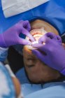 Hohe Winkel der Ernte Kieferorthopäde in Handschuhen Installation von Veneers auf den Zähnen zum Schutz während der Verabredung in der Klinik — Stockfoto
