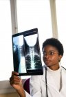 Médico feminino preto jovem em pé perto da janela e examinando a varredura de raios X enquanto trabalhava na clínica — Fotografia de Stock