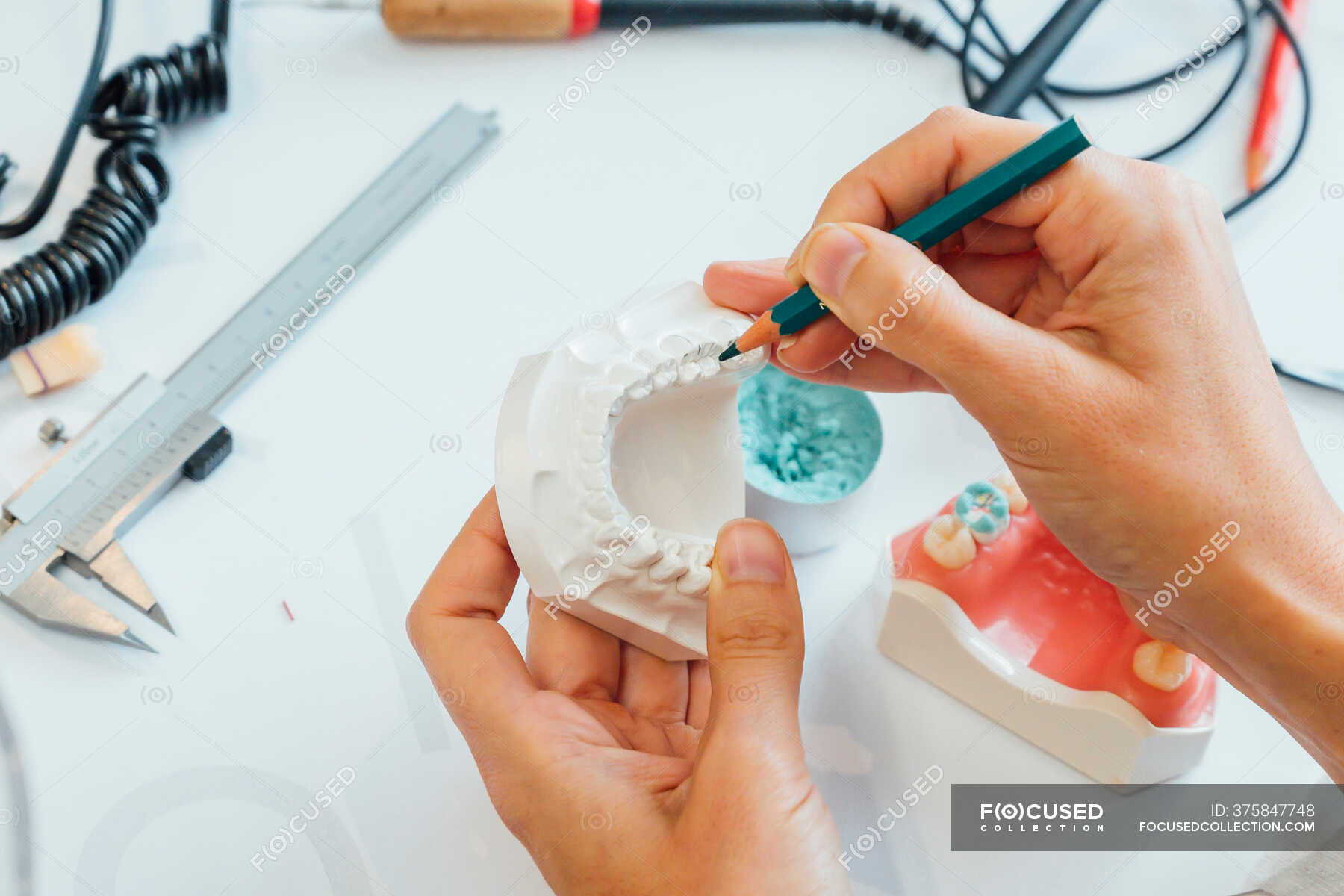 From above of crop orthodontist with pencil in hand working with white