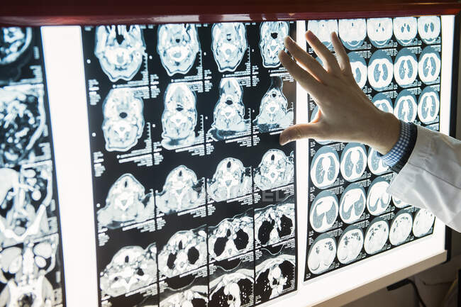 Hand einer Person mit einem Röntgenbild auf dem beleuchteten Hintergrund. — Stockfoto