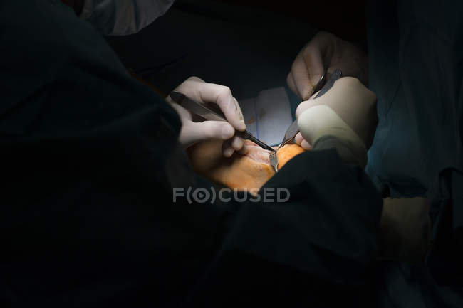 Cirujanos manos haciendo la operación - foto de stock