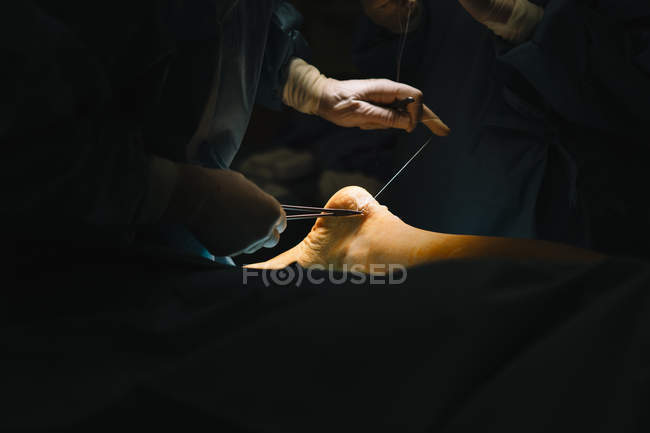 Surgeon sewing up leg after operation — Stock Photo