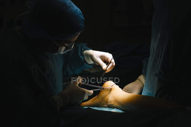 Хирург зашивает Ахиллесово сухожилие — стоковое фото
