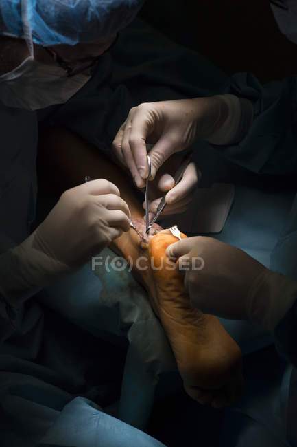 Cirujanos manos haciendo la operación - foto de stock