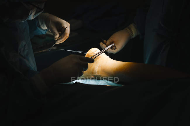 Операция рук хирургов — стоковое фото