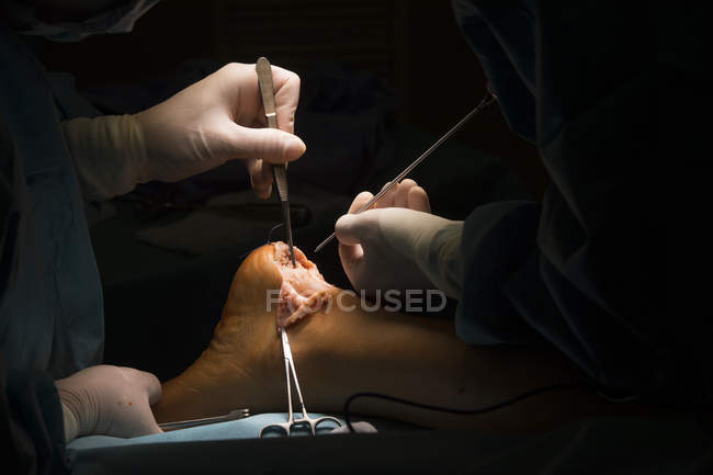 Chirurgen Hände machen Operation — Stockfoto
