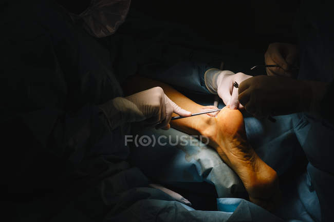 Chirurgiens mains faisant opération — Photo de stock