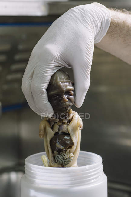 Crop hand in glove holding ahead of the dead fetus wet specimen. — Stock Photo