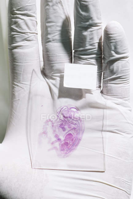 Guante de mano con una impresión transparente de un feto - foto de stock