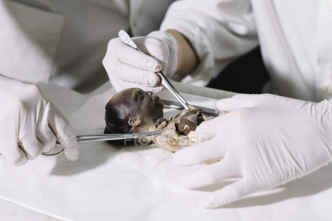 Crop hands providing autopsies of  fetus with lancet. — Stock Photo