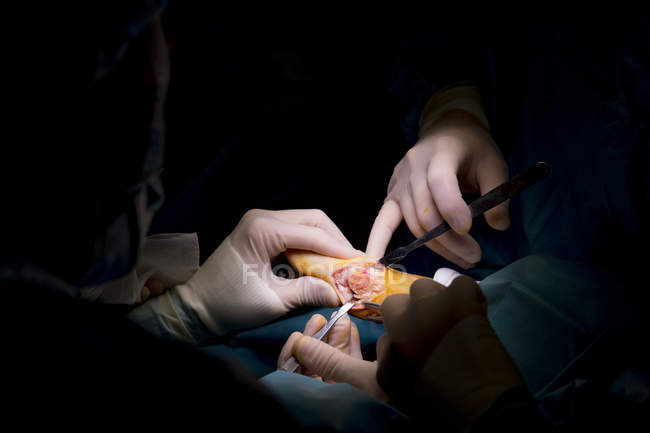 Close up view of surgeons hands performing operation on patients leg — Stock Photo