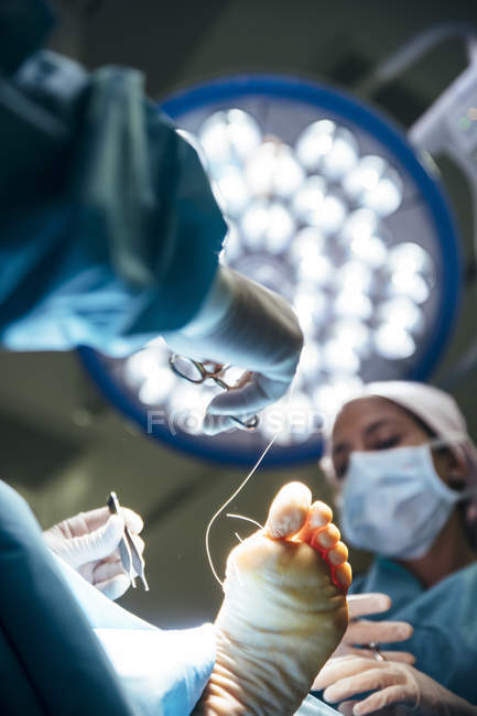 De abajo el tiro de los cirujanos que cosen el pie del paciente en la luz brillante de la lámpara . - foto de stock