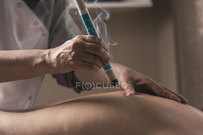 Terapeuta realizando tratamento de moxabustão — Fotografia de Stock