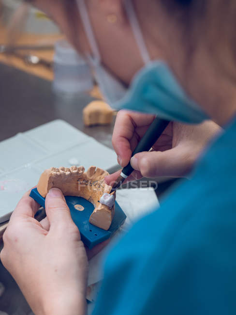 Стоматолог наносить речовину на зубний протез — стокове фото
