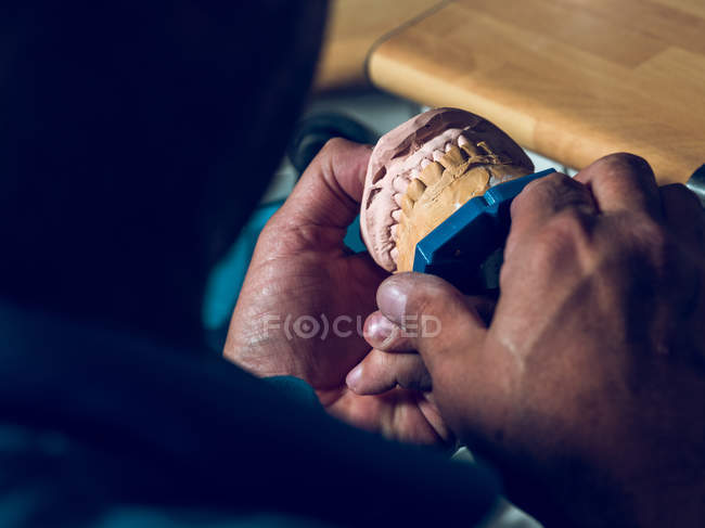 Mani che tengono la dentiera — Foto stock