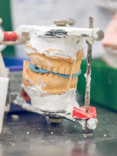 Artificial teeth on holder — Stock Photo