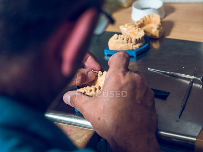 Manos masculinas sosteniendo prótesis dentales - foto de stock
