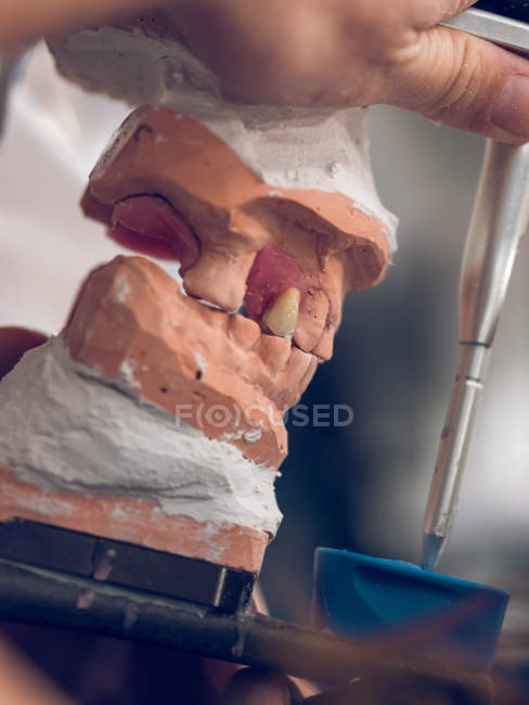 Hand making denture cast — Stock Photo