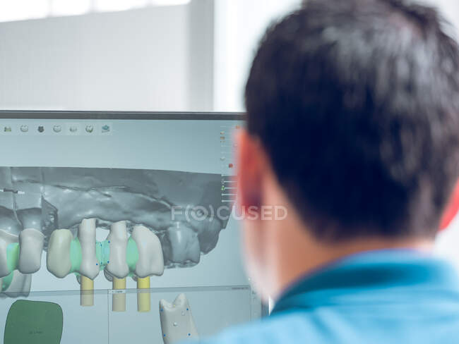 Hombre sin rostro modelando dentadura postiza en computadora - foto de stock