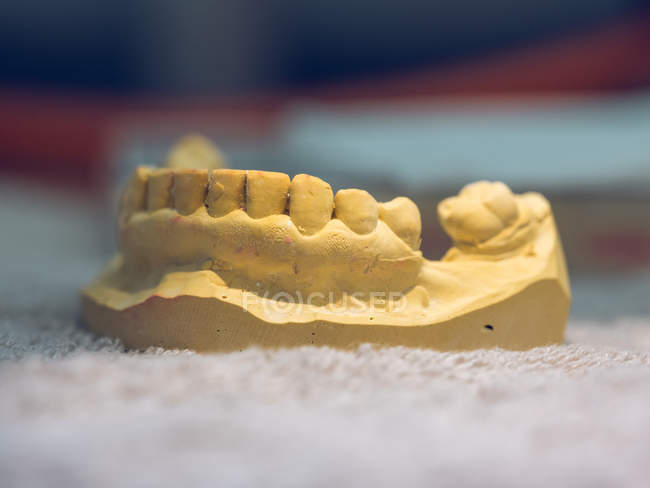Molde de dentadura em laboratório — Fotografia de Stock