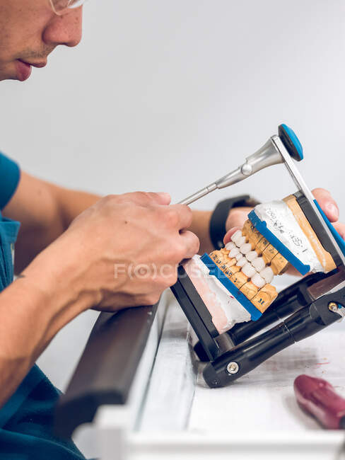 Dental technician holding artificial teeth on holder — Stock Photo