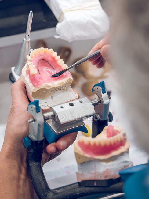 Técnico dentário aplicando substância na prótese — Fotografia de Stock