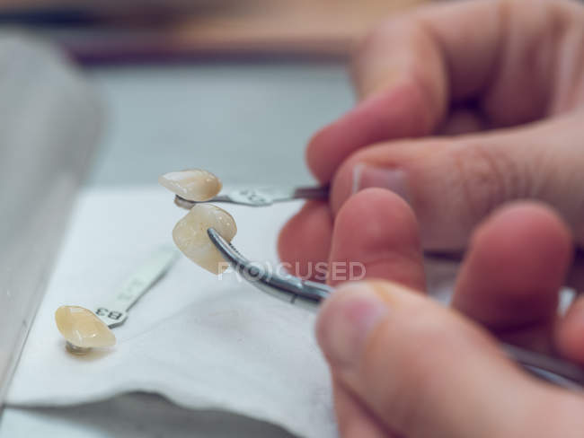 Técnico dental tallando dientes - foto de stock