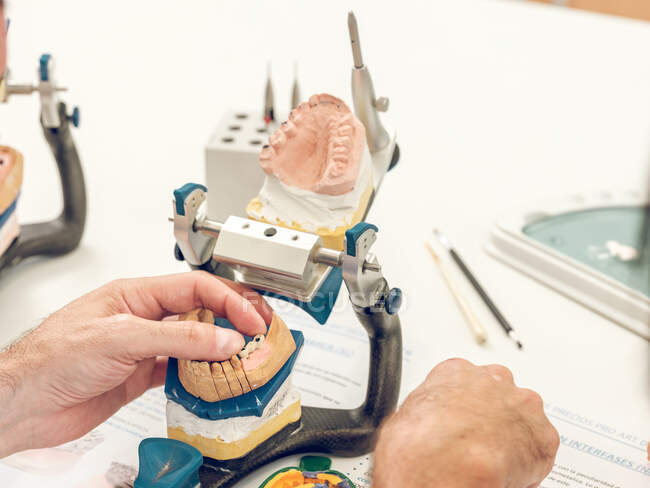 Стоматолог робить зубний протез — стокове фото