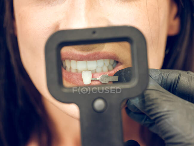 Dentiste choisir la couleur de la prothèse dentaire — Photo de stock