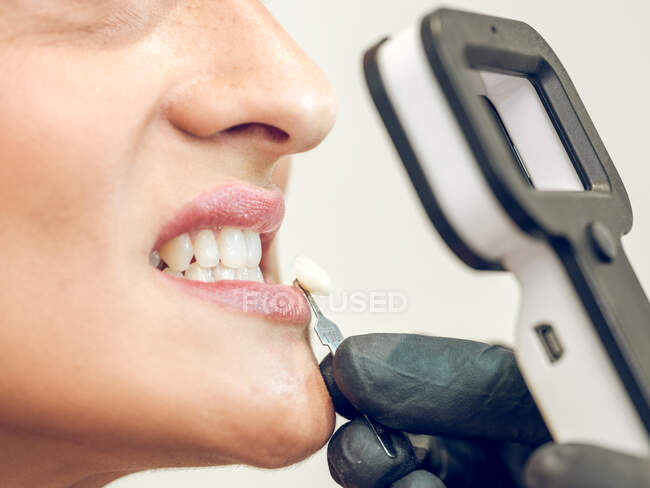 Mano del dentista que elige el tinte de dentadura para la mujer - foto de stock