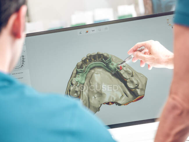 Dentist models jaw на комп'ютері — стокове фото