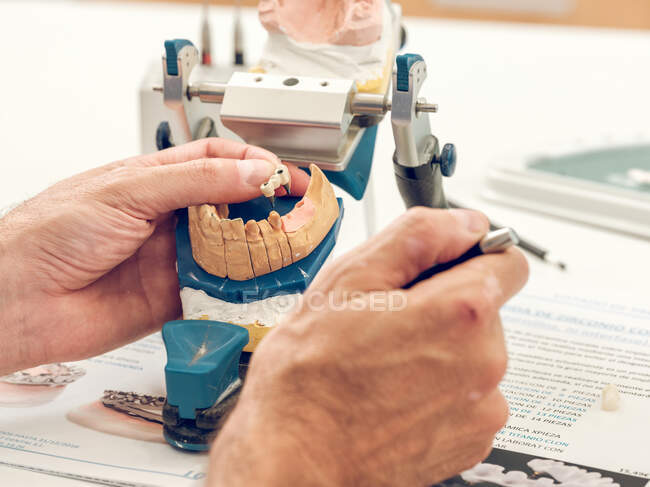 Hands of dental technician making a denture on stand with special equipment — Stock Photo
