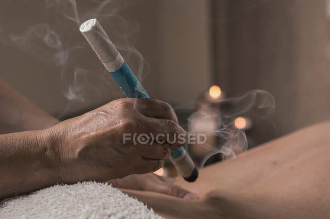 Terapista che esegue il trattamento di moxibustione in sala massaggi — Foto stock