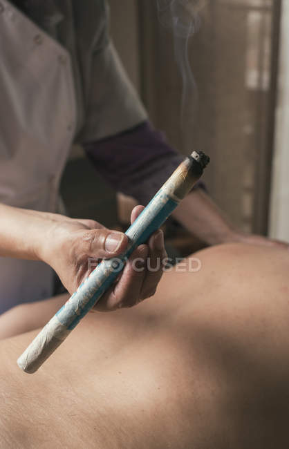 Thérapeute effectuant un traitement de moxibustion dans la salle de massage — Photo de stock