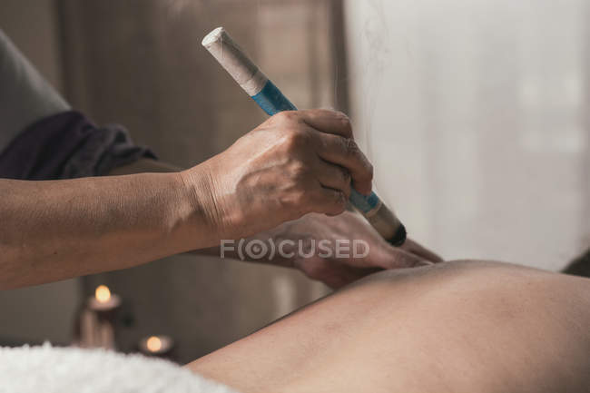 Терапевт, выполняющий процедуру моксисгорания в массажном кабинете — стоковое фото