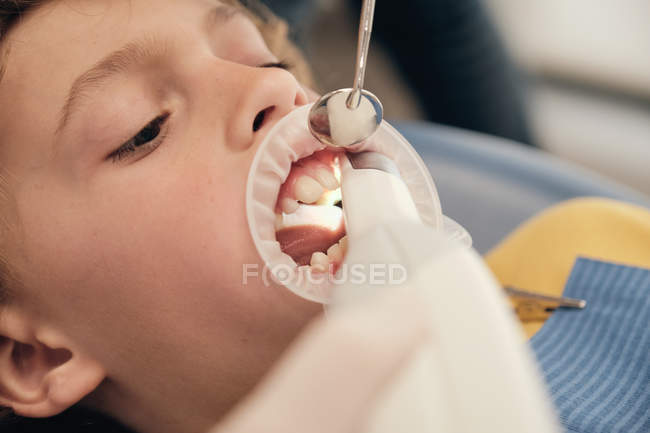 Hände des Arztes bei der Untersuchung der Zähne des kleinen Jungen während der Arbeit in der Zahnarztpraxis — Stockfoto